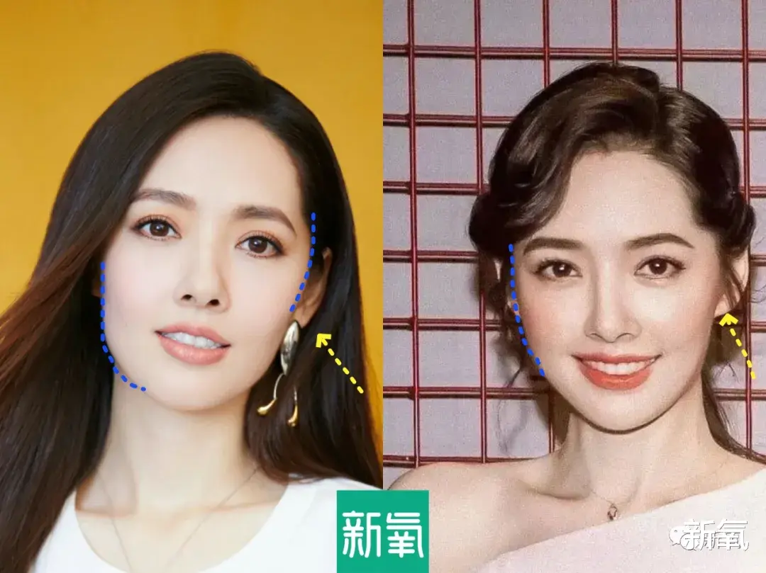 减脂|是时候停止高颅顶审美PUA了