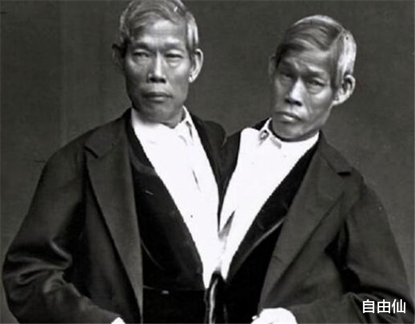 连体|华裔连体兄弟在美国发财后，娶了一对洋姐妹花，后来生下22个孩子