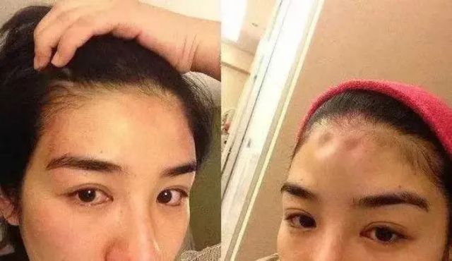 李小冉|李小冉被前任拿艾滋针头抵喉，黄奕家里装满摄像头，阿娇更惨