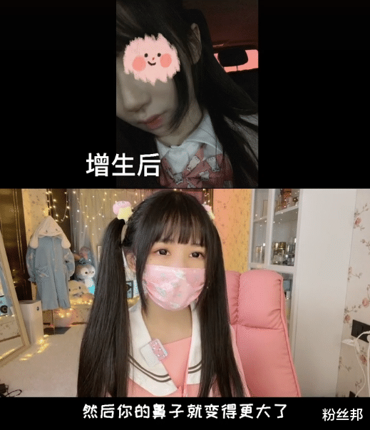 蔡萝莉|蔡萝莉回应戴口罩的原因，自卑做3次整形手术，提醒网友不要动脸