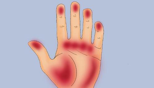 长寿|肝脏好不好,“手脚”先知道?夏养肝,坚持四件事,可事半功倍