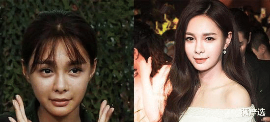 黑色素|泰国女子连续打了6年“美白针”，如今的变化，网友直呼不可思议
