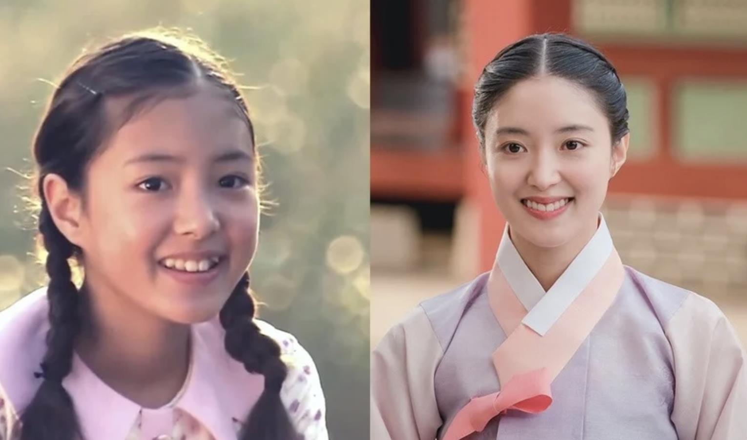 童星|7位“长大颜值更高的童星”，李世荣天然美，俞承豪颜值翻倍