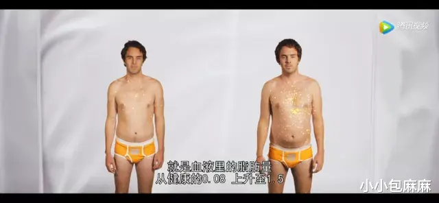 小小包麻麻|女孩吃甜食吃成1500度近视，原来糖的危害远不止蛀牙