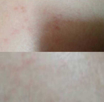 fashion美尚|女人会不会长妊娠纹，这3个细节早就有暗示，不用生完孩子才知道