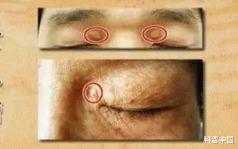面相|注意！这几种面相可能预示着心脏疾病，很多人都忽视了
