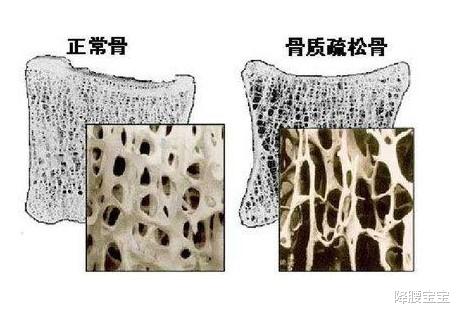 雌激素|50岁左右的女性，雌激素多好还是少好？补得越多越好吗？补多久