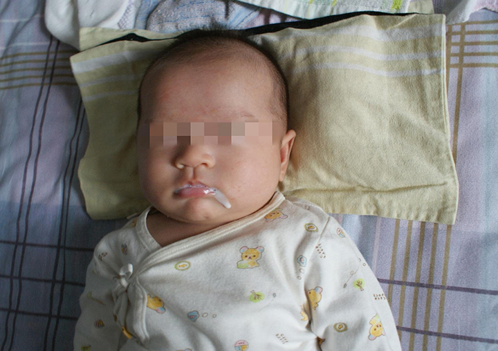 两口育儿|宝宝吐奶，父母只会拍嗝？是时候学习“新技能”了，既有效又实用