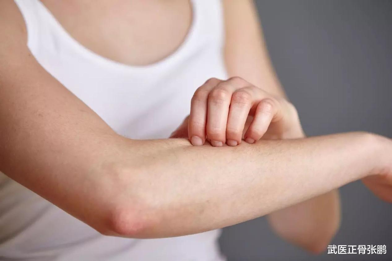 肝脏|40岁男子身上发痒确诊肝癌,医生:身体2处“瘙痒”,尽早检查肝功能