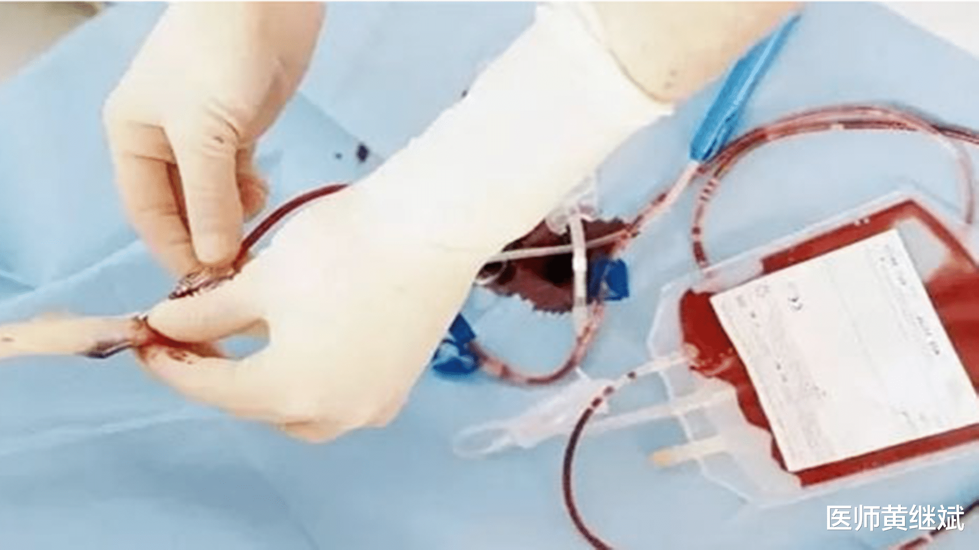 医师黄继斌|脐带血的事，读懂这篇你就懂了，建议读完再决定留还是捐