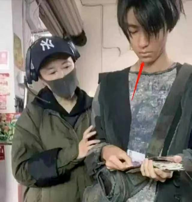 罗云熙|男明星追求“畸形瘦”，王俊凯暴瘦老十岁，罗云熙只剩“筷子腿”