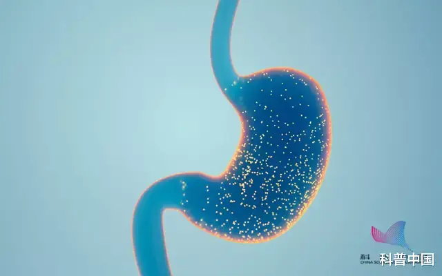 胃癌|23岁女孩胃疼两周确诊胃癌,全胃切除!这些症状很多人都忽视了