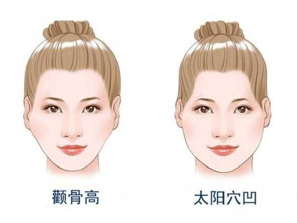 瘦脸|什么脸型瘦了不好看