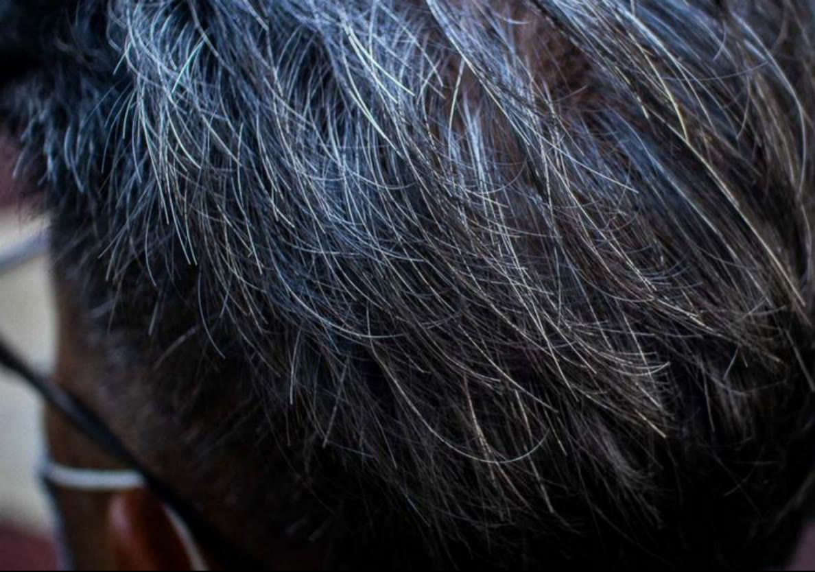 行星 一夜白发是真的！科学家强调：别忽略压力带来的可怕后遗症