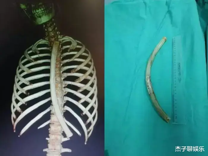 女孩|把50cm仙女管直插体内，称会上瘾的女大学生，别再透支生命了