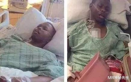 人工心脏|一个没有心脏的男人,坚强的活着努力锻炼,你还有什么理由叫苦?