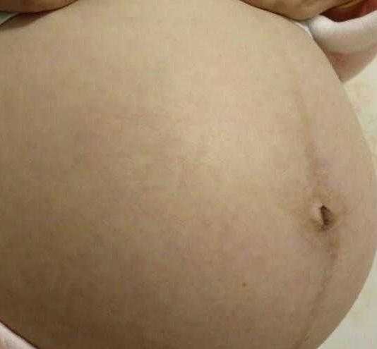 fashion美尚|女人会不会长妊娠纹，这3个细节早就有暗示，不用生完孩子才知道