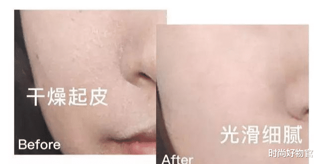 时尚好物官|为什么不建议女人做“拉皮”？做过的人很后悔，老公：丢人到家