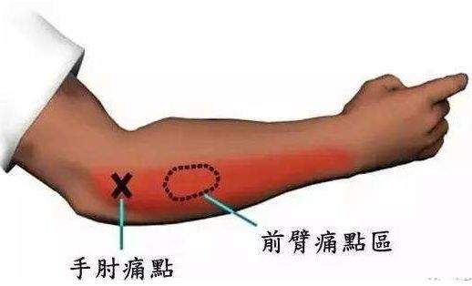 饵料|别人钓鱼身强体壮、心情愉悦，而你钓鱼却病魔缠身、苦不堪言