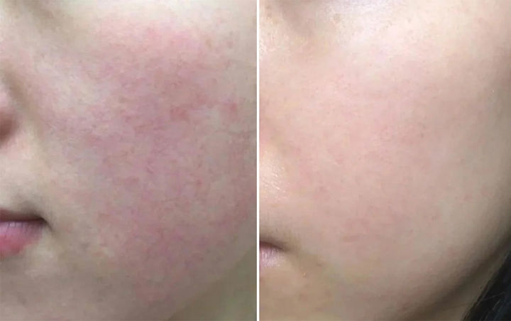 护肤品|建议：逛超市时，碰到这6款护肤品别手软，看着不起眼，却很好用