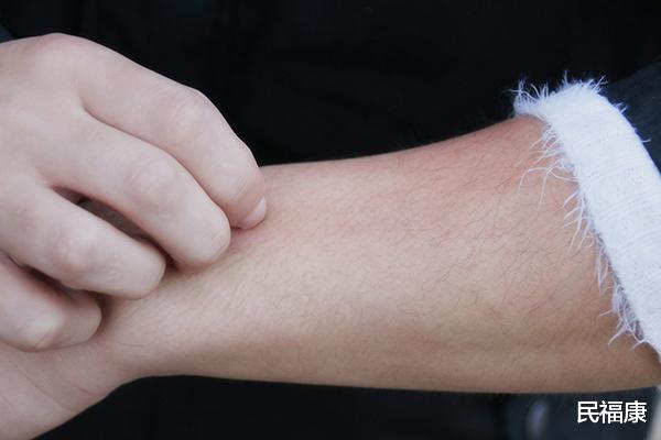 热水器|洗完澡身上还是很痒，是没洗干净吗？冬季洗澡，4个习惯要改正