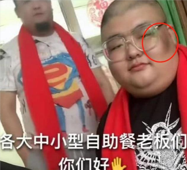 戏虹星 网传泡泡龙去世与黑斑有关，网友称其为“尸斑”，专业医生回应来