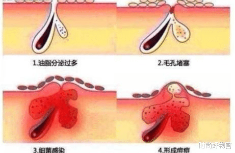 护肤|74岁奶奶与孙子合照意外走红，“冻龄”状态惹人羡，护肤或是关键