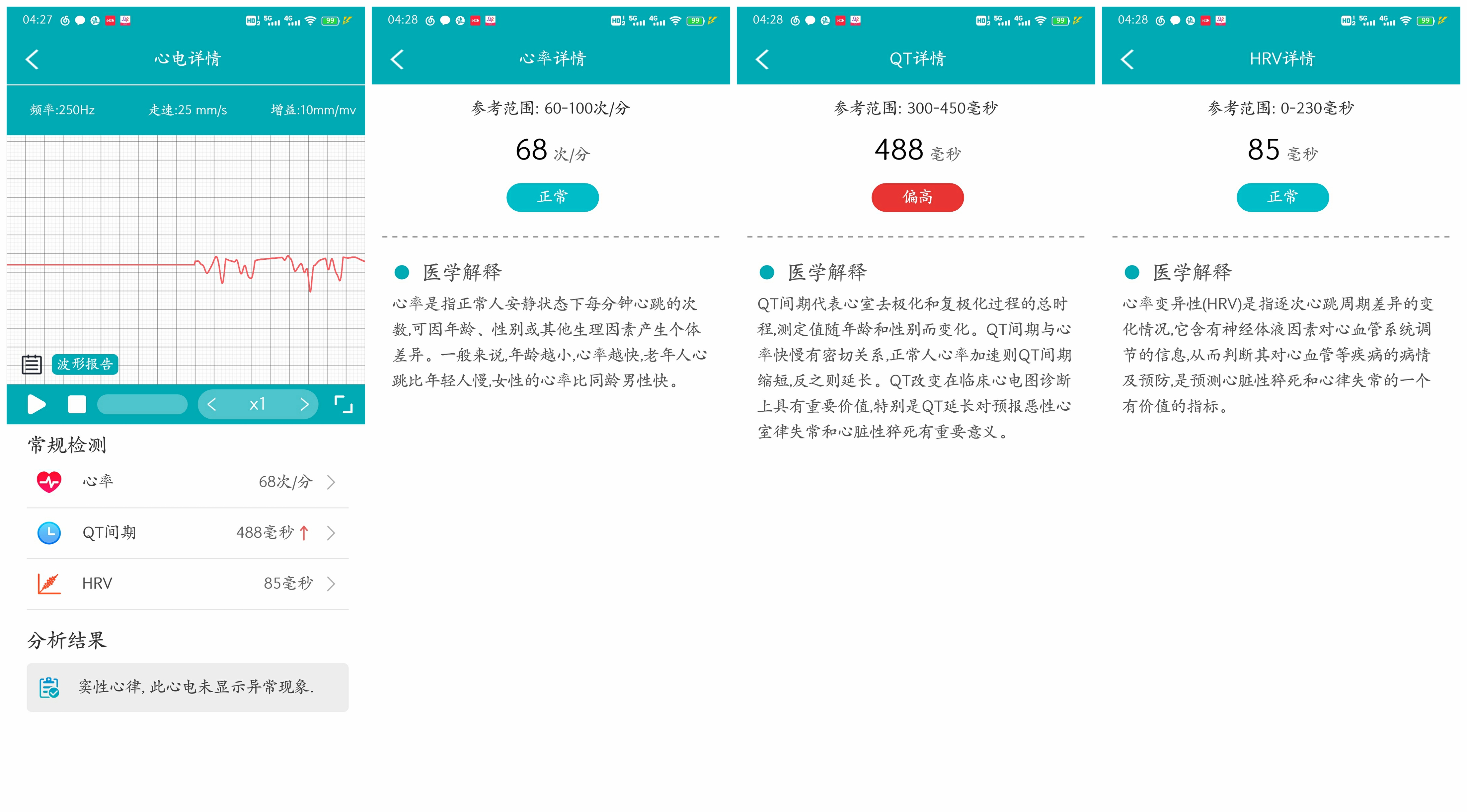 dido|送给爸爸妈妈的健康管家，高精准血压血氧智能手环——dido智能手环