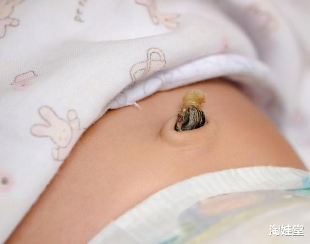 淘娃堂|肚脐眼里的“黑泥”是啥，不能抠掉吗？显微镜放大千倍后，真酸爽