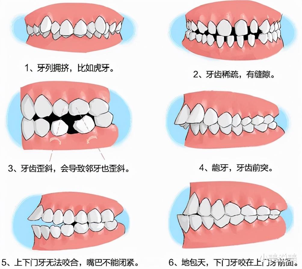 小美说美 笑，没有感染力？离不开这几个原因