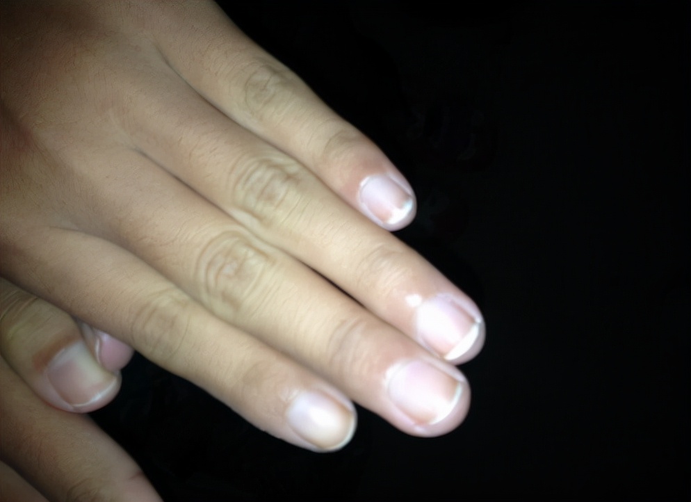 肝脏|多家医院联合呼吁：停止食用“1粗粮”，比酒精还伤肝脏，赶紧扔