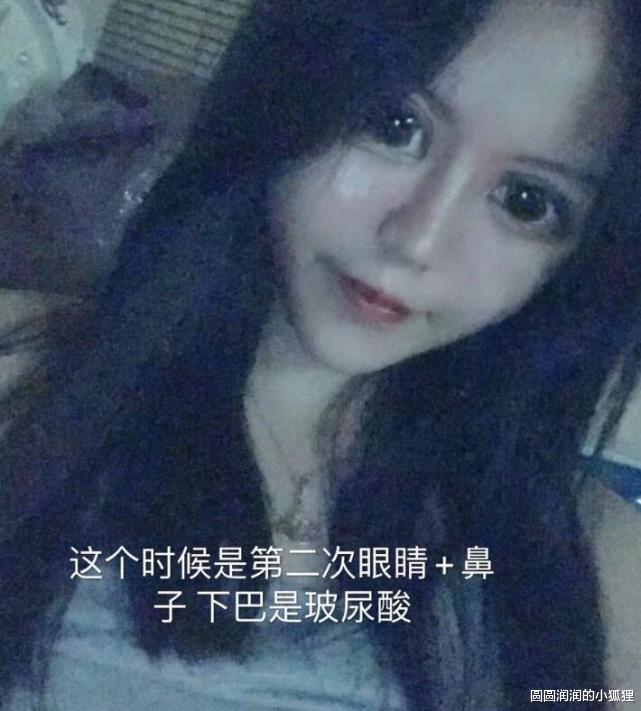整容|15岁女网红花费400万整容，天天晒照自认为很美，网友吐槽像60岁