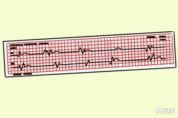 心脏|普通人心率多少算正常？心率过快、过慢有何影响？