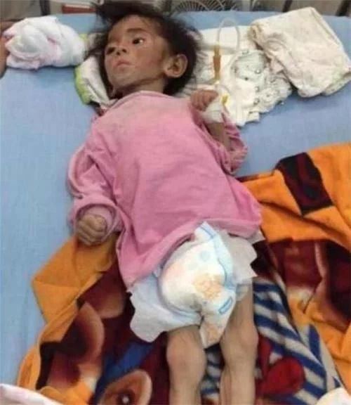 女孩 5年前女网红收养“皮包骨”女孩，曾饱受众人质疑，现状打脸众人