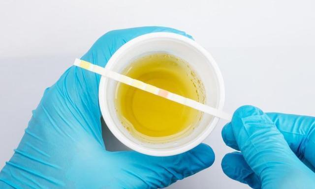 尿酸|水喝多了,排出的尿酸越多?尿酸偏高的人,几个饮水误区建议了解