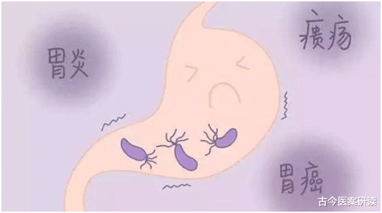 口臭|幽门螺杆病菌怕“一水”，每天敞开喝，胃健康，口臭消失