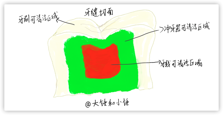 爆肝一个月，14款热门冲牙器/水牙线详细测评，强烈建议收藏！