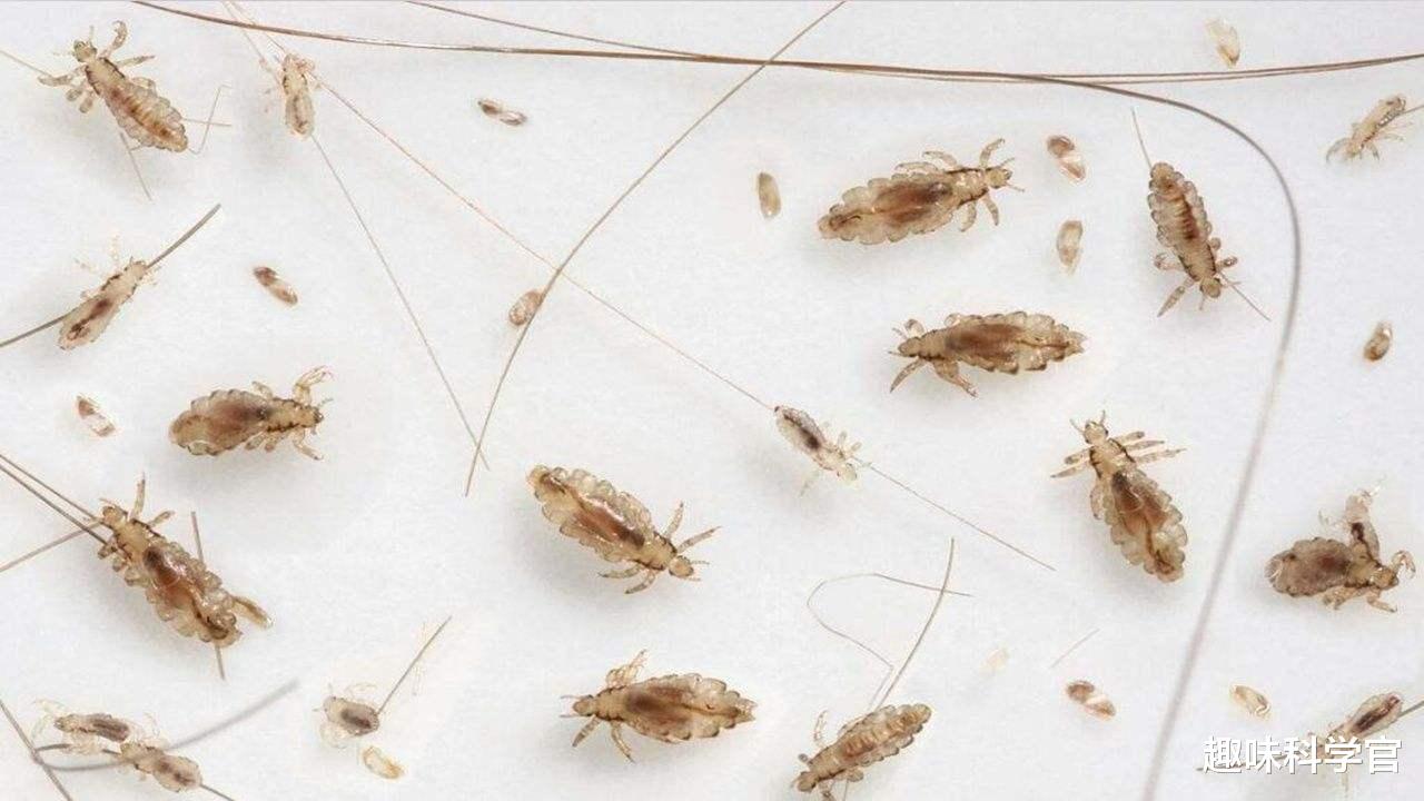 哺乳动物 七八十年代人头身上几乎都有虱子，为何后来忽然消失不见了？