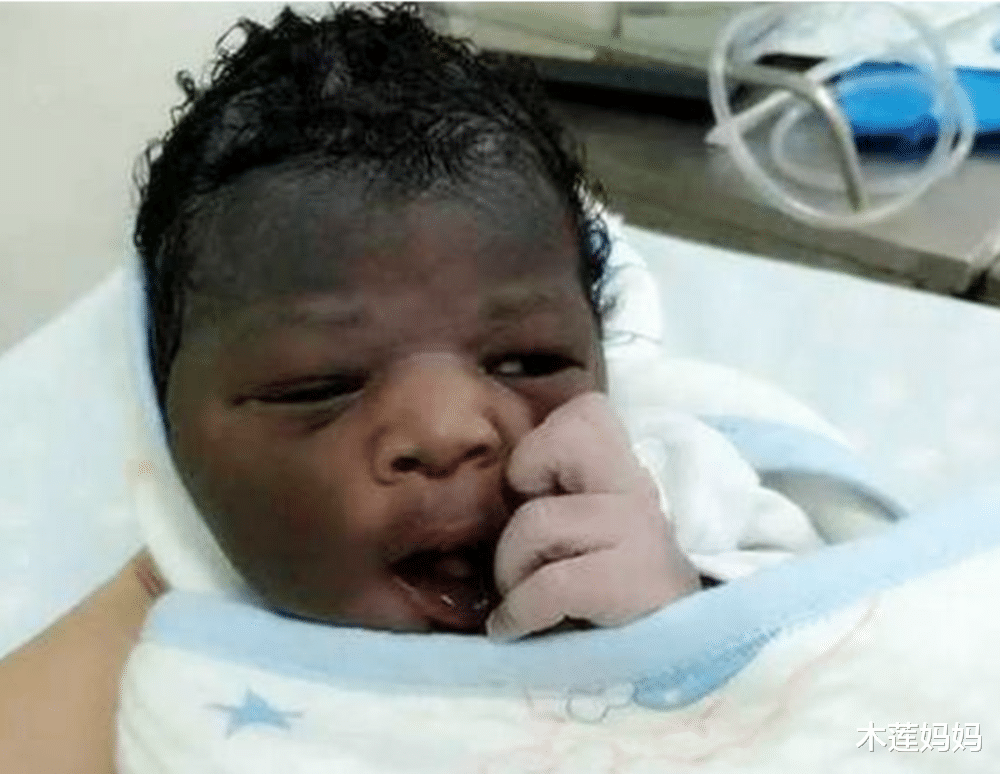 木莲妈妈|父母皮肤白，却生下“黑宝宝”，宝宝肤色太黑多半跟这些因素有关