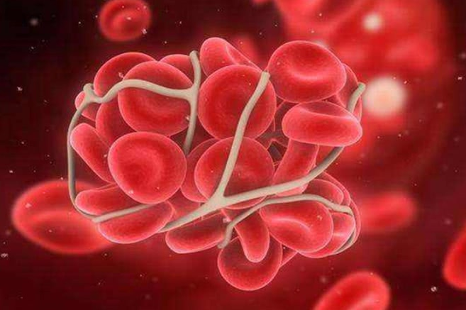 千金芳|吃一口等于5斤芹菜，医生呼吁：血液粘稠常吃，清血管降血脂，血管会更好