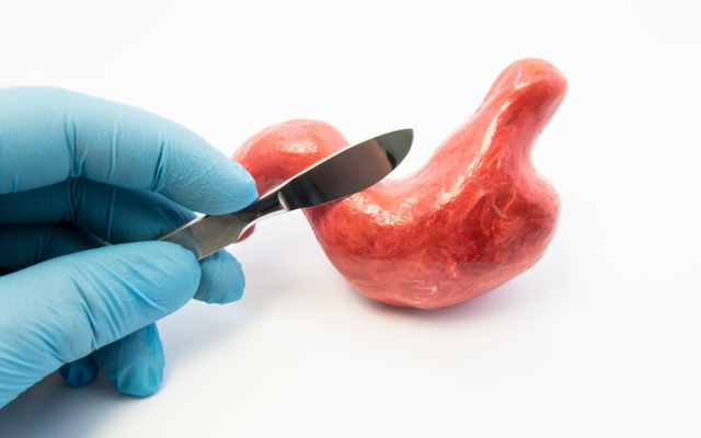 降压药|胃病“祸因” 已公布！消化科医生：烟酒未上榜，榜首很多人喜欢