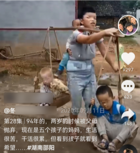 育儿宝屋|我有遗传病但坚持生了五胎：一个白化病、一个唇腭裂、一个精神病