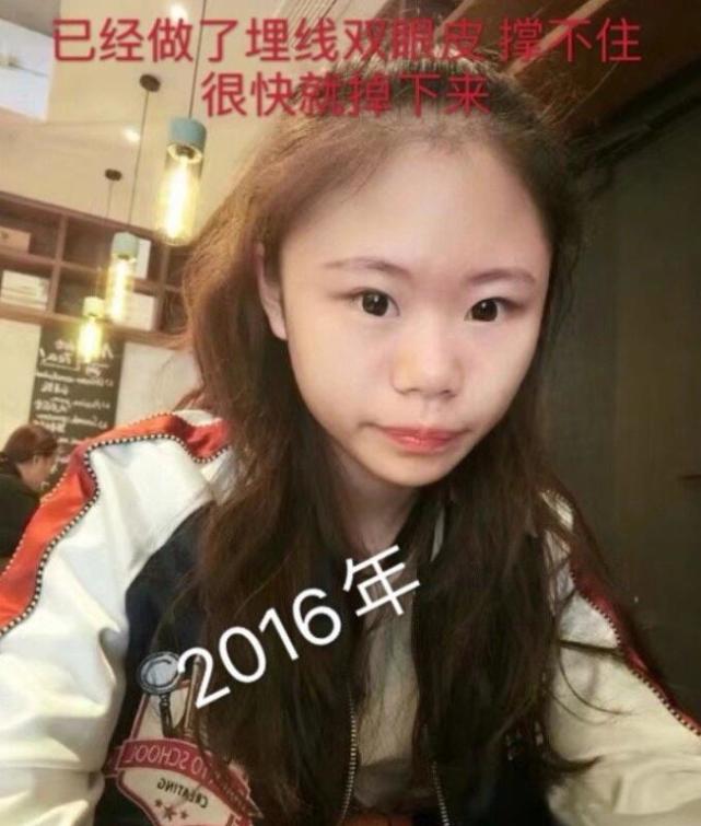 张卫健|15岁女网红花费400万整容成瘾，天天晒照自认为很美，网友吐槽像60岁