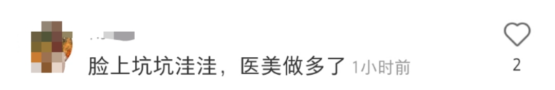整容|53岁伊能静素颜现身迪士尼，面部凹陷耳垂变形，生图被疑医美过度