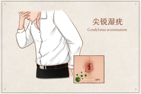 hpv疫苗|HPV疫苗对男性也有保护效力？专家告诉你！