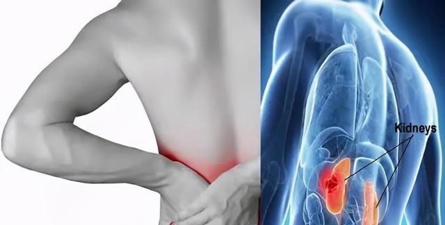 诗采春 肾功能受损，有哪些症状？如何判断一个男人肾好不好？