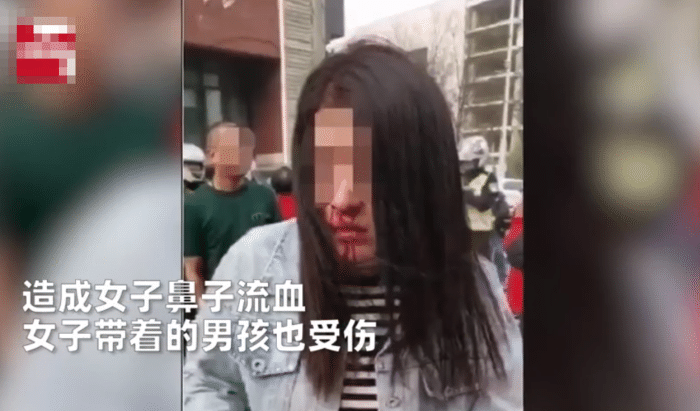 亚洲播报一姐 女子剐蹭奔驰遭殴打后续：女子鼻骨骨折却选择和解，引发网友热议