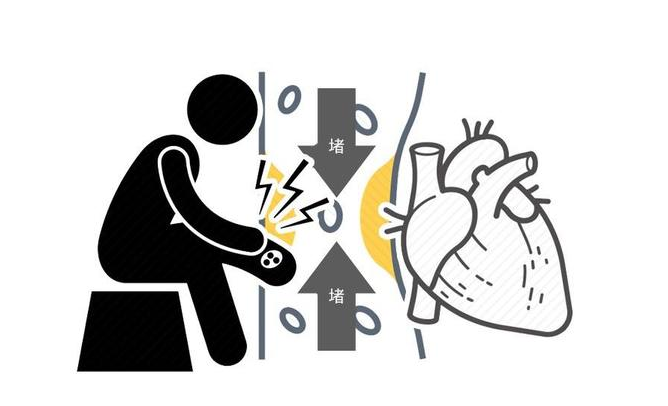 苹果|血管变窄悄然无声？仔细观察，腿上出现2个异常，或正在暗示你