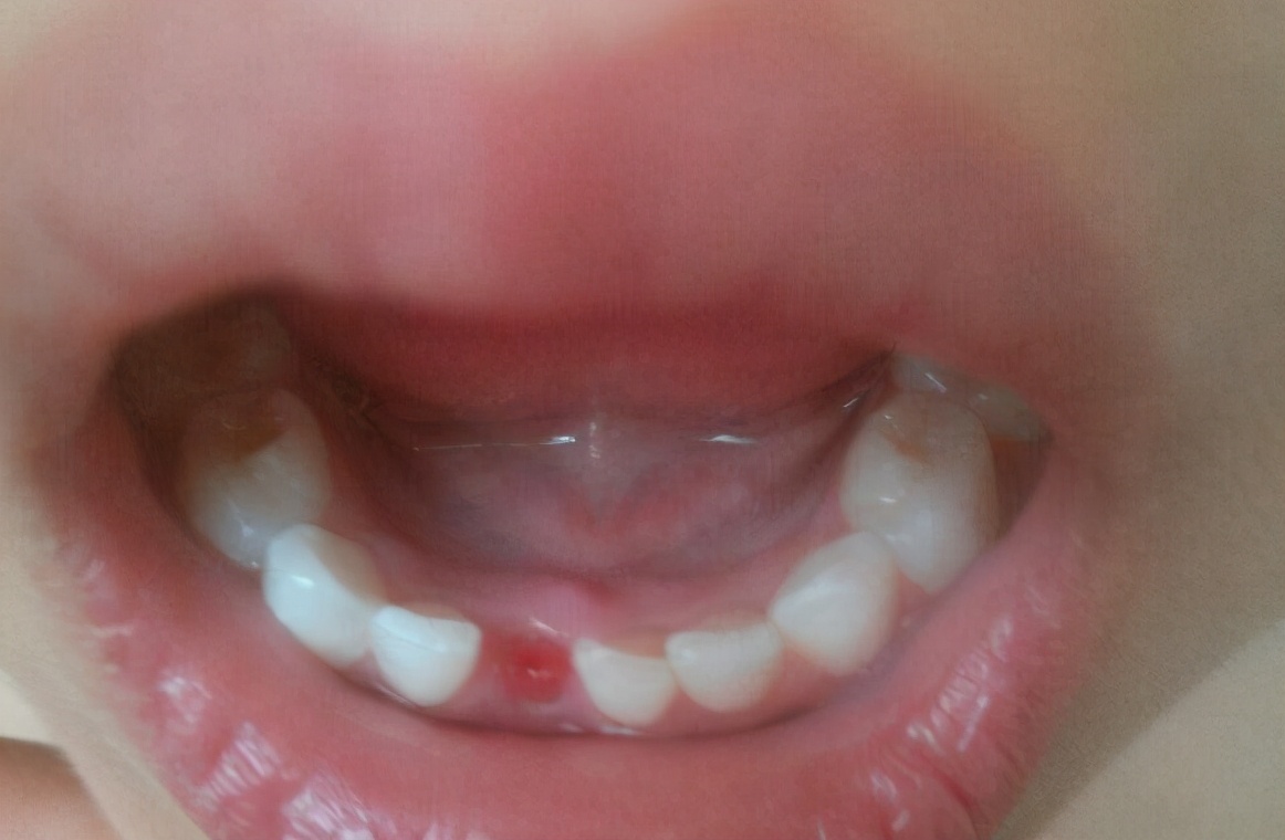 火星 鲨鱼一生可换数万颗牙，鳄鱼可换50次牙，为什么人类只能换一次？