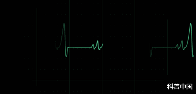 心脏|总感觉\心突突跳\是怎么回事？熬夜会增加心脏病的风险吗？